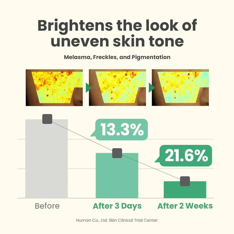 Axis‑Y Dark Spot Correcting Glow Serum – lightweight brightening serum with 5% niacinamide and botanical extracts for hyperpigmentation – Alire Beauty